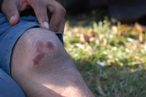 En 15-årig kille ramlade när han jagades av polishundar i Bulgarien. Bild: Johanna Senneby